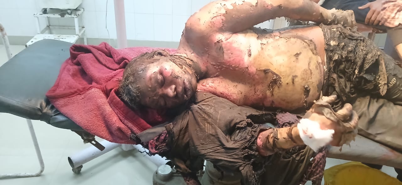 Prem Nath son of Ram resident working at a private dhaba at Shahpur died due to unknown fire.